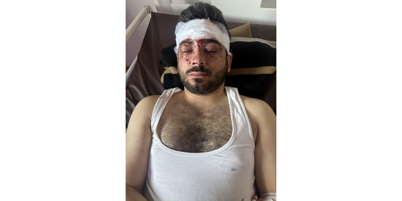 Anadolu reporter among 3 injured in Syria mine blast