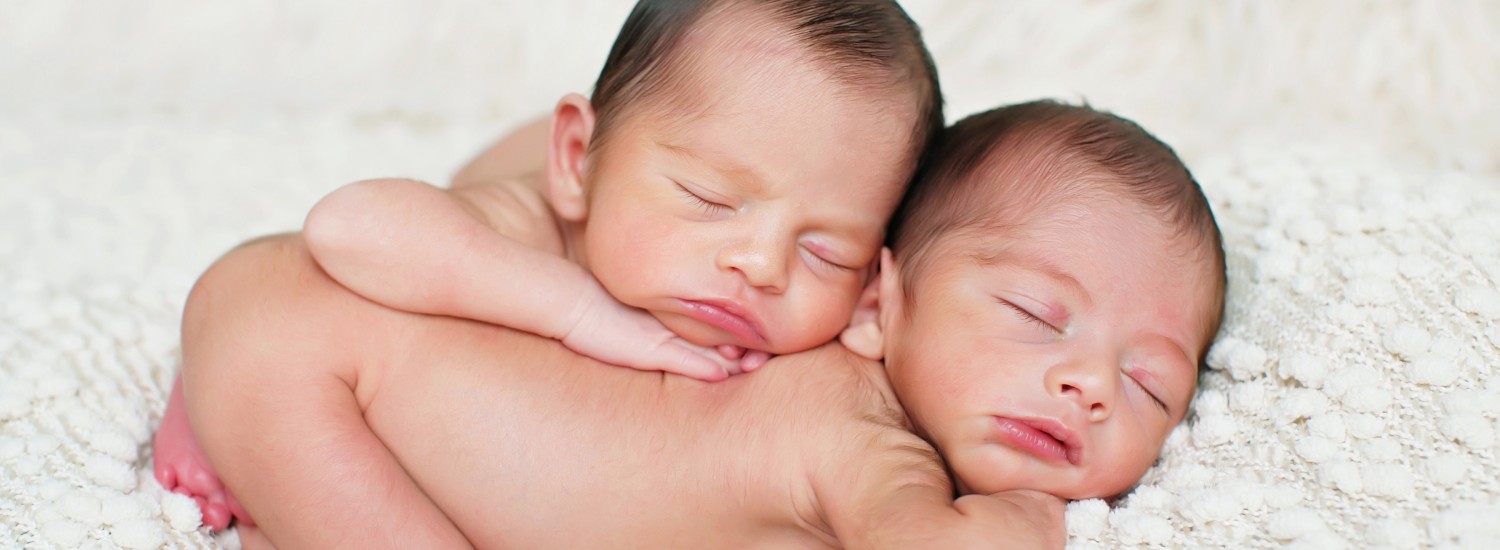 Doctors separate conjoined twins at NY hospital