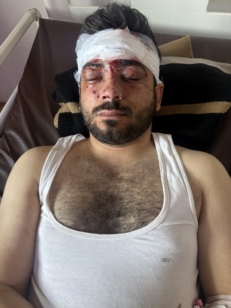 Anadolu reporter among 3 injured in Syria mine blast